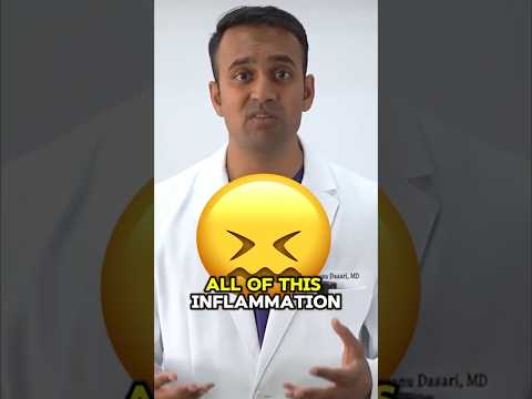 Top SIX MISTAKES to avoid with Ulcerative Colitis! #health #guthealth #ulcerativecolitis #gutissues