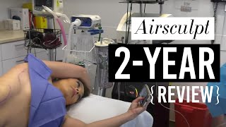 Airsculpt 2-Year Review: Would I do it all over again (Before & After Included)