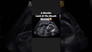 Look at that little mouth moving at 6 months 🥰 #jerbearimaging #mouth #baby #sono #ultrasound