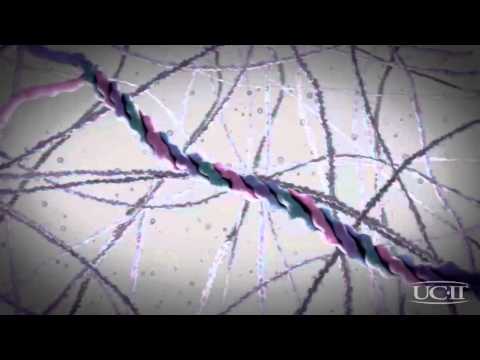 UC-II - a unique form of undenatured Type II Collagen