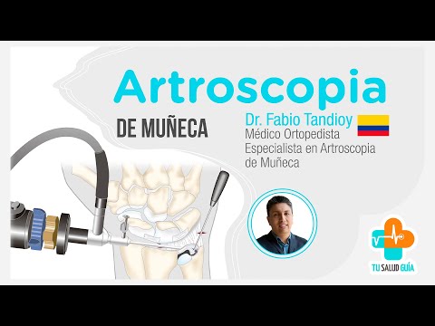 Wrist Arthroscopy | Reporte Dental