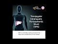 Discover the Minimally Invasive Treatment Option for Liver Diseases: TIPS Procedure| Swagat Hospital