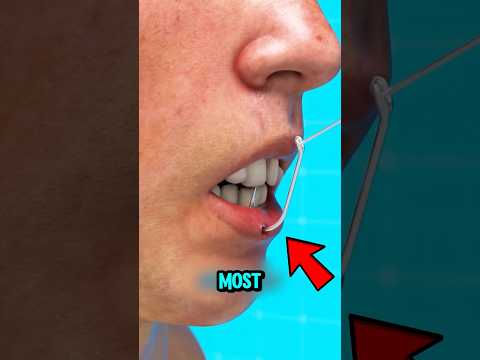 NEVER Pull Out a Fish Hook Like This! 😱 The Safe Way That Actually Works