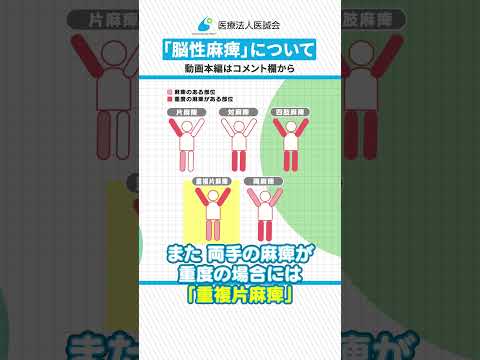 片麻痺について詳しく解説