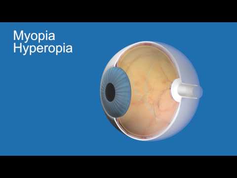 myopia kezelése a kezdeti szakaszban