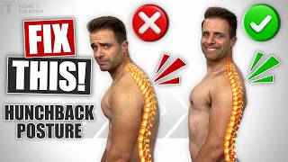 The Real Fix for Hunchback Posture [Do THIS Daily!]