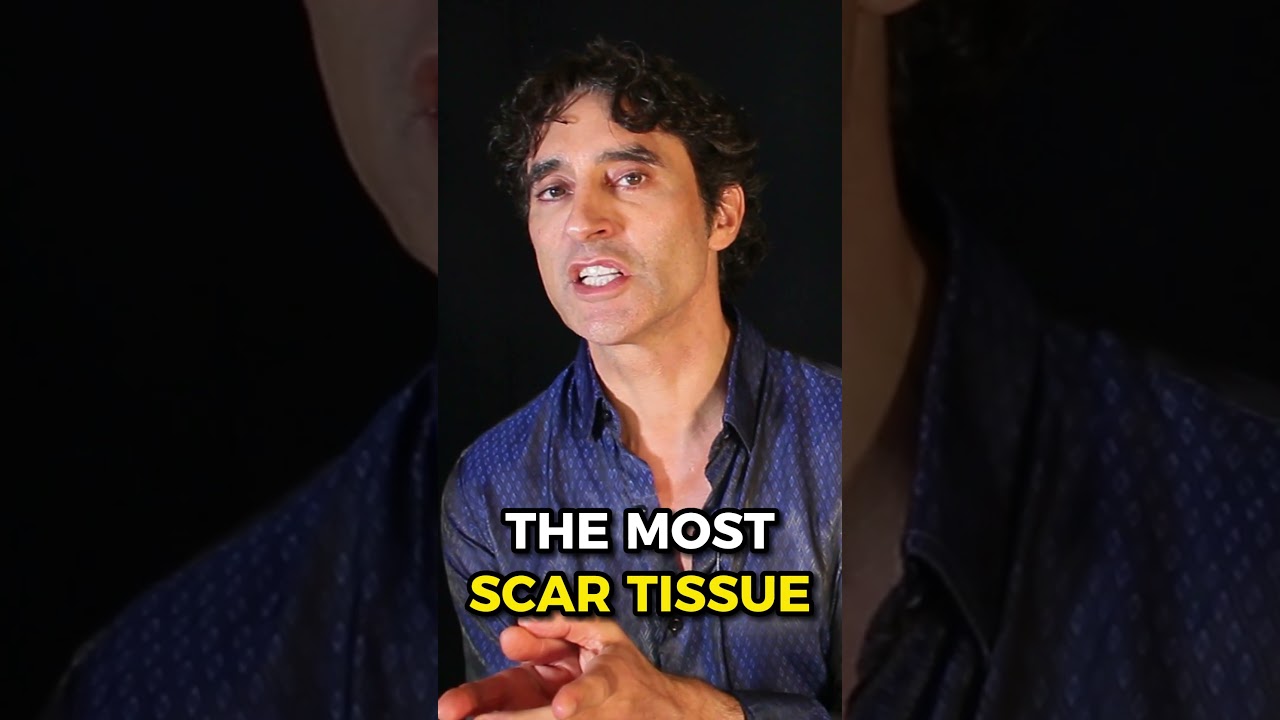 😨 FACELIFT SURGEONS ARE SCARING YOU 😨 SCULPTRA