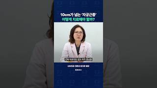 10cm 이상 자란 자궁근종, 수술로 제거해야 할까?