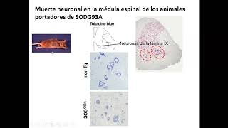 Muerte neuronal en ELA 2020