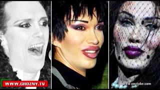 Становясь жертвами неопытных косметологов, девушки платят за временный эффект с побочными действиями 