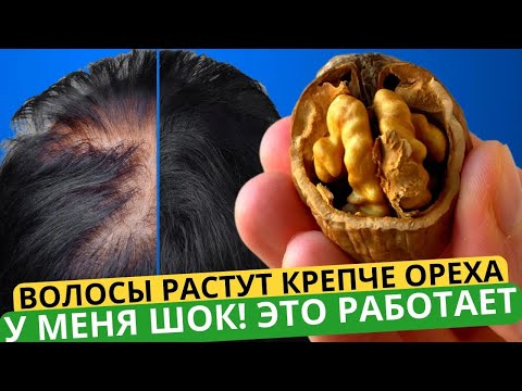 Just 1 spoon in SHAMPOO, and any HAIR will grow like crazy! They even grow on bald spots...