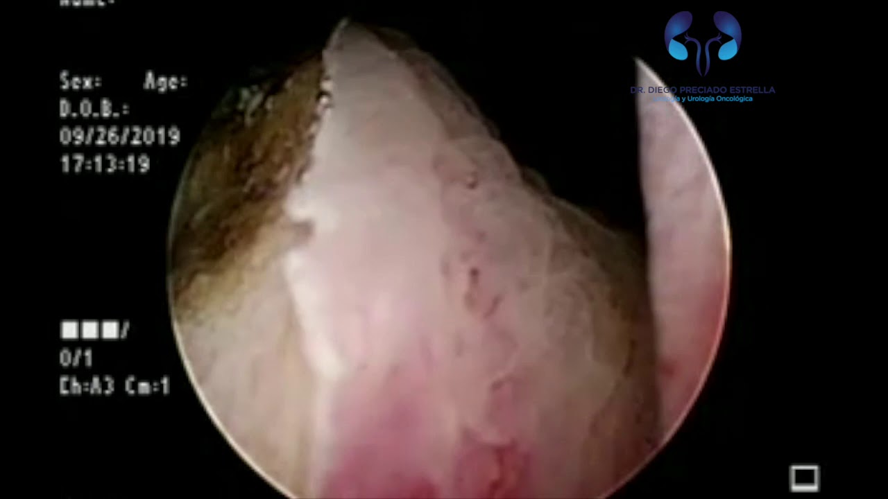 Diego Preciado Estrella-13