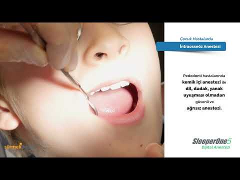 ICCPD 2024 Sponsor Video | Intraosseous Anesthesia (SleeperOne5) by DentalHiTec and Sürmeli Dental