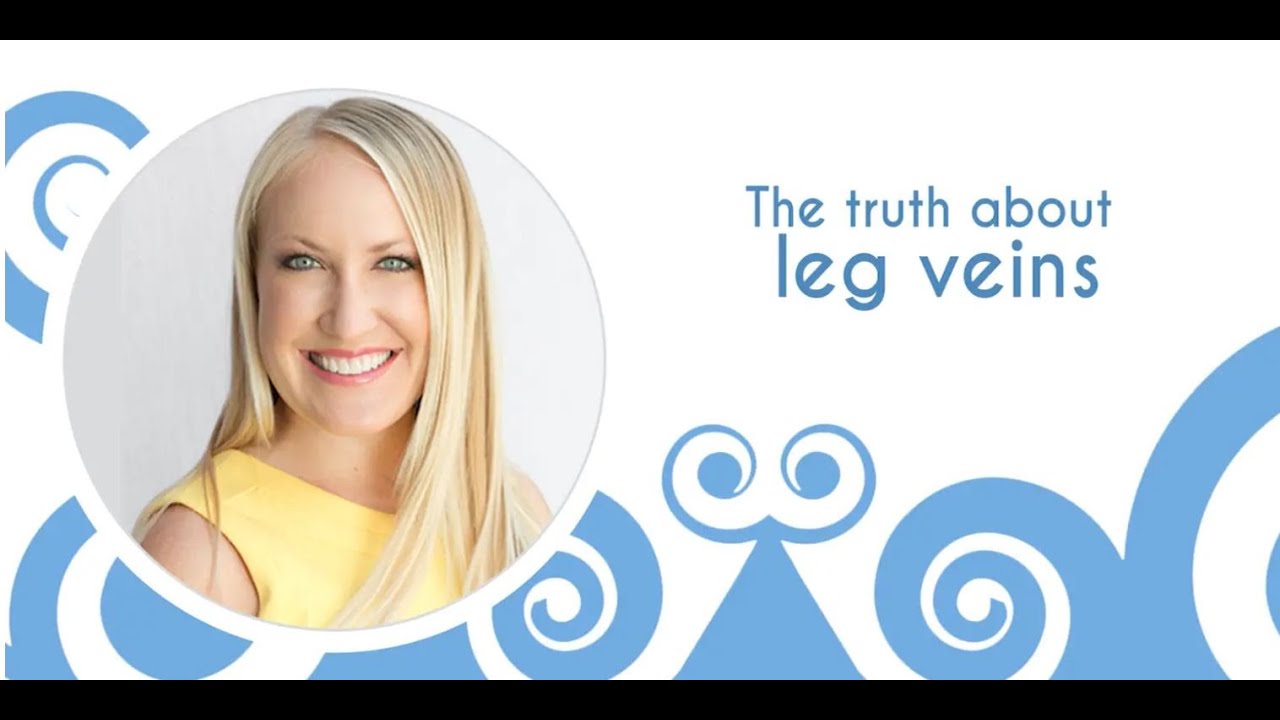 The Truth About Leg Veins - Encinitas CA