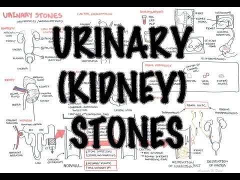 Urinary/Kidney Stones - Overview 