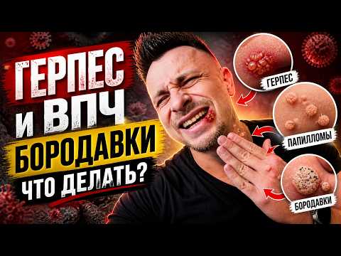 Герпес, ВПЧ, бородавки: что делать и как лечить правильно
