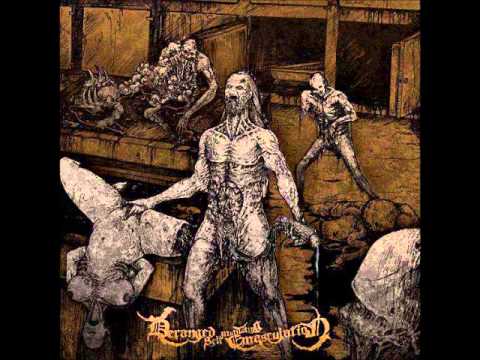 Epicardiectomy - Deformed To Shapeless Cadaver