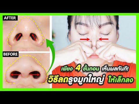 โบท็อก ปีกจมูก