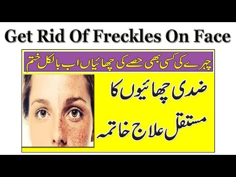 How To Get Rid Of Freckles On Face Permanently || Anam...