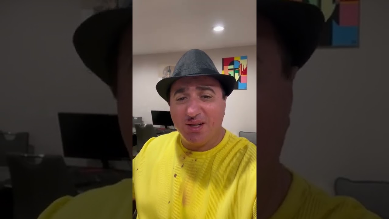 ԱՄՆ-ում ծեծի են ենթարկել դերասան Սոս Կարապետյանին