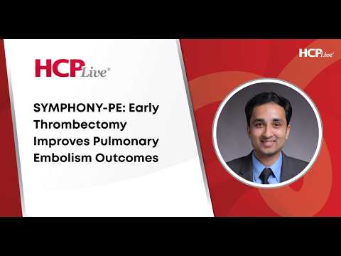 Early Thrombectomy Improves Pulmonary Embolism Outcomes