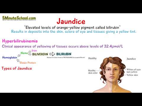 WHAT IS JAUNDICE? - SIMPLE EXPLANATION OF 3 MAIN CAUSES