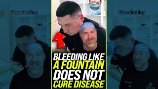 Bloodletting Does NOT Cure Disease 😱 #shortsbetai
