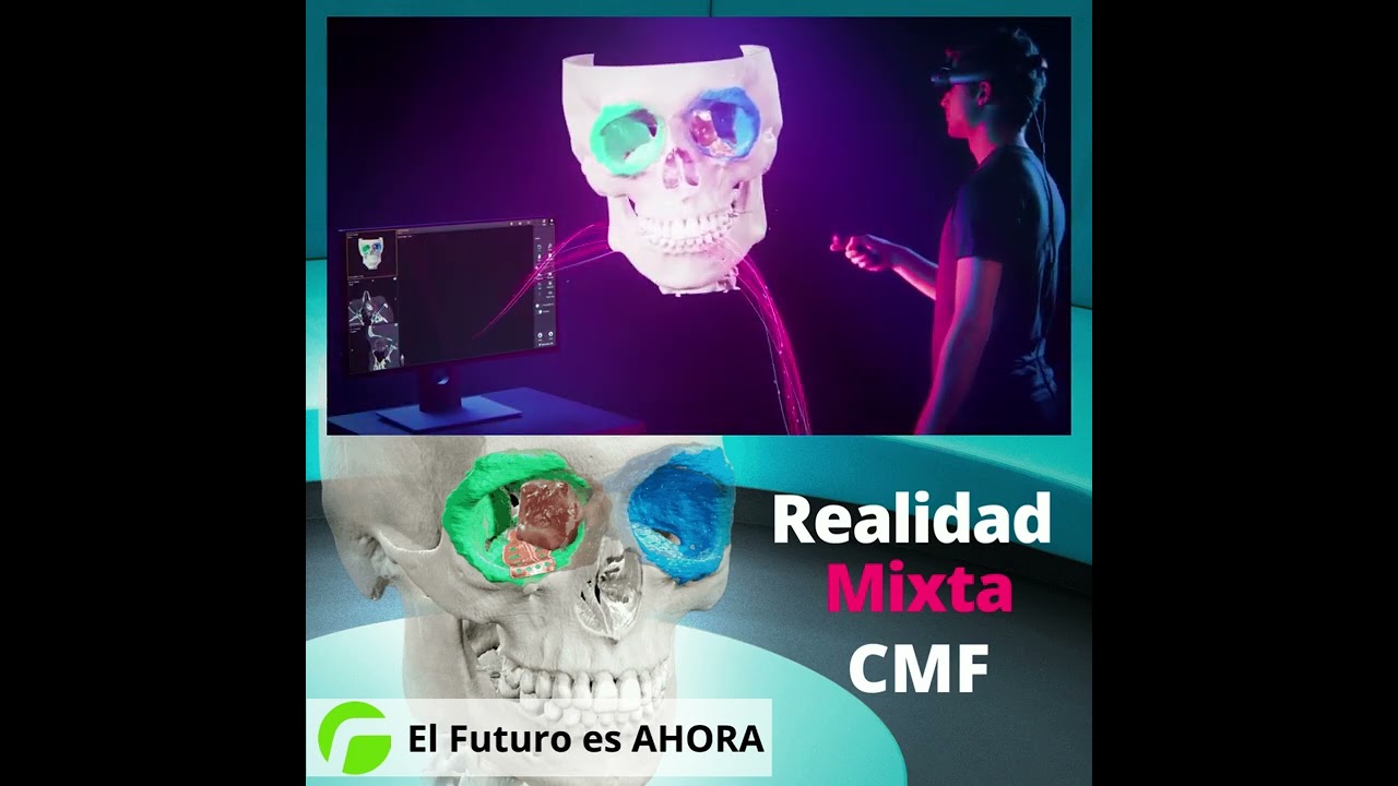Realidad Mixta CMF