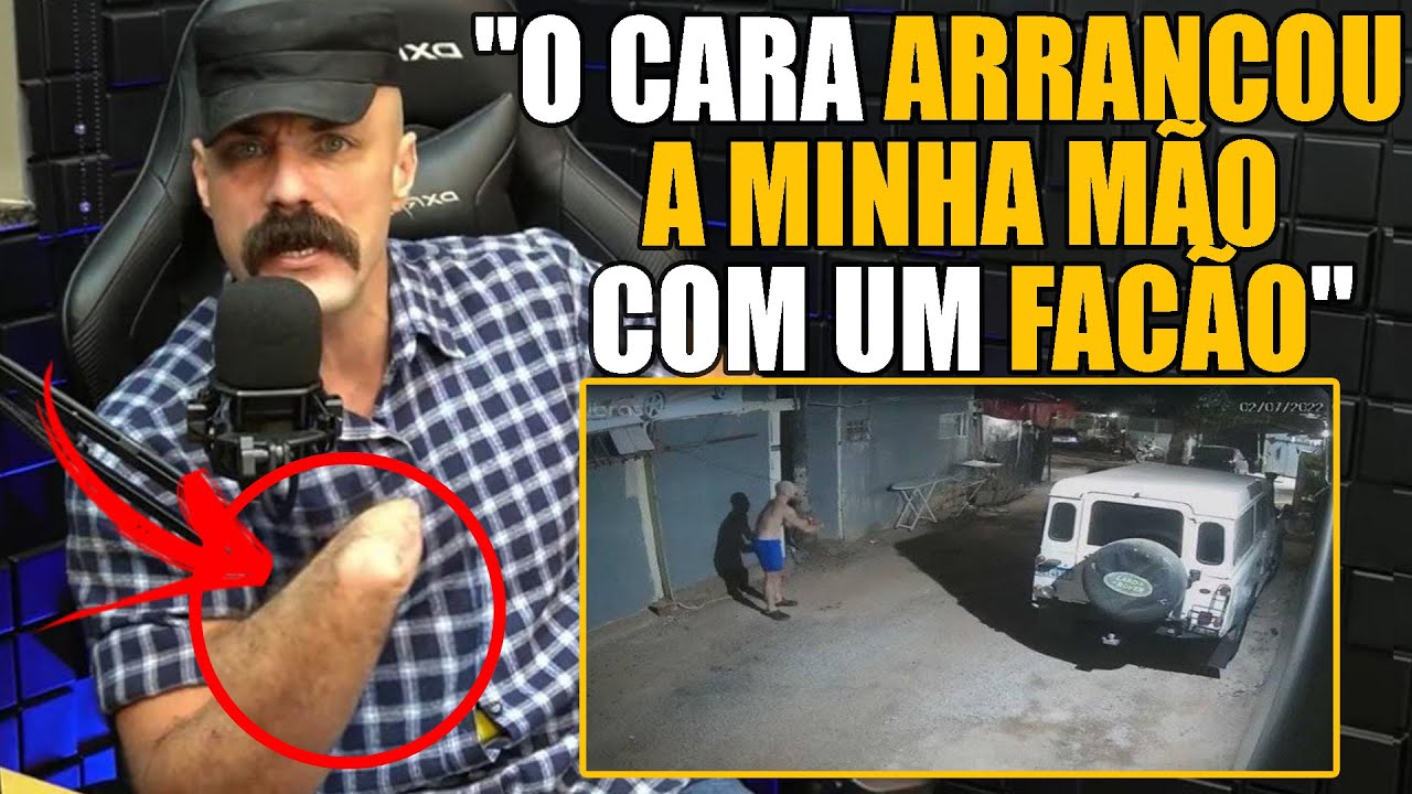 POLICIAL CONTA COMO PERDEU A MÃO EM UMA OCORRÊNCIA - PERCIBORGUE