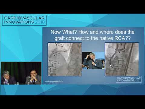 CVI2018 Session: TwinPass Torque to the rescue - Ashish Pershad, MD