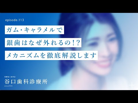 第113話 ガム ・キャラメル で銀歯は、なぜ外れるの⁉️メカニズムを徹底解説します❗️–札幌駅前-赤れんがテラス6階-谷口歯科診療所