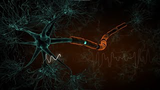 Understanding multiple sclerosis (MS) and the role of NfL testing with a simple blood test