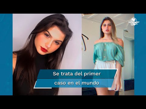 Gemelas trans se someten juntas a cirugía de reasignación de género en Brasil