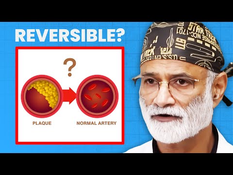 Can You Actually Unclog Arteries? | Dr. Pradip Jamnadas