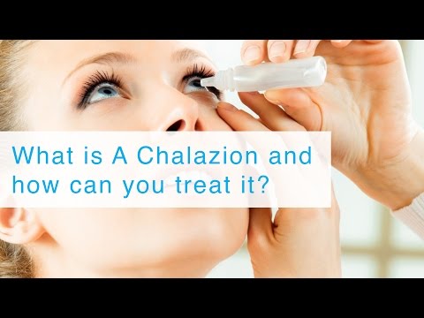 download lagu mp3 mp4 Chalazion Homeopathy, download lagu Chalazion Homeopathy gratis, unduh video klip Chalazion Homeopathy