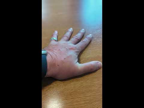 Die 5-Finger-Atemübung