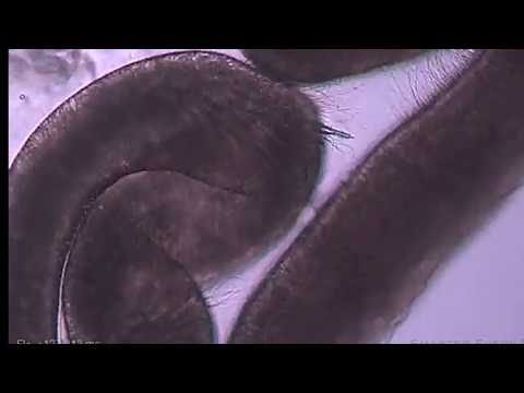 Stinging Cells And No Brains As Well! What Are Cnidarians?