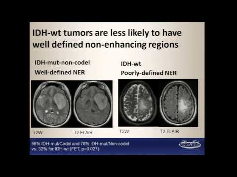 image-What is the TCIA cancer archive?