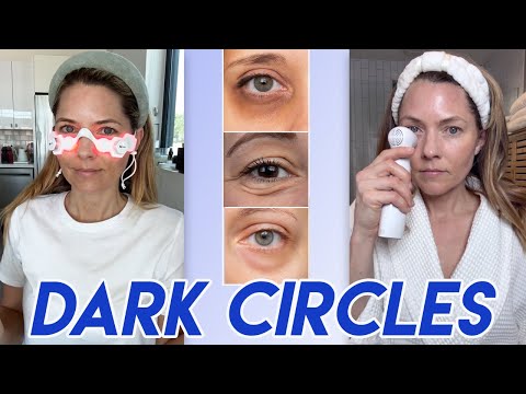 Ultimate Under-Eye Dark Circle Regimen: Devices That Actually Work (Nira, LED, Microcurrent & More)
