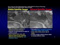 Weather Maps Available To Mariners Visible Infra Red And Water Vapour Images