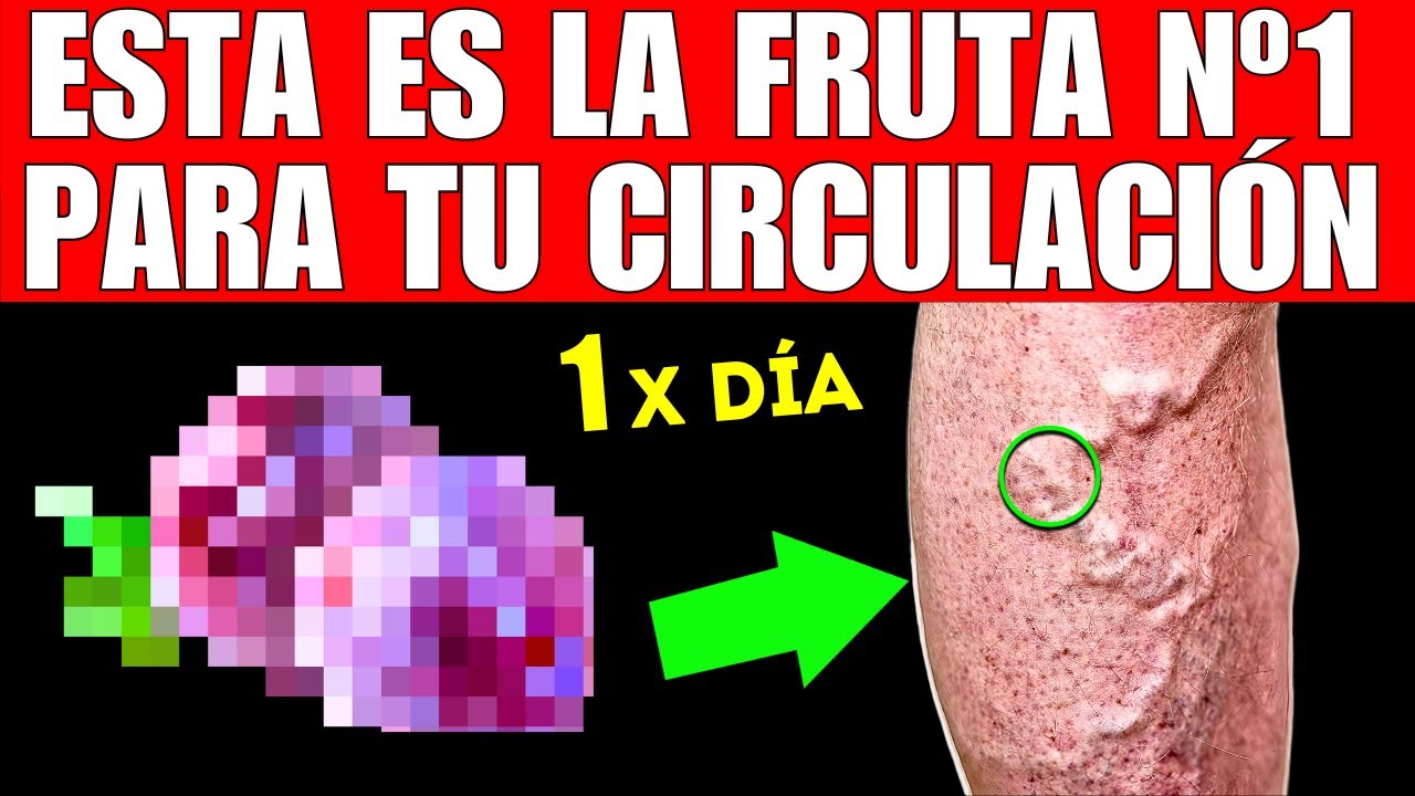FRUTA #1 que MEJORA la INSUFICIENCIA VENOSA (¡No Más VARICES!)