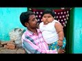 Huge 53lb Toddler Won T Stop Growing