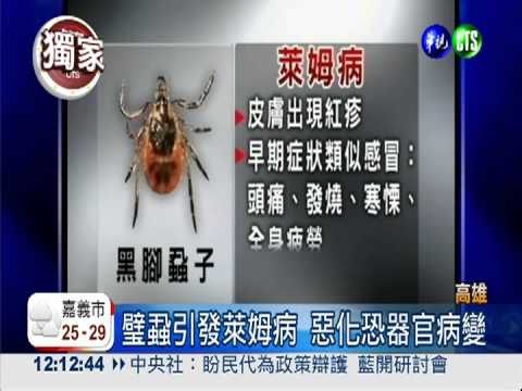 璧蝨叮咬染萊姆病 惡化恐病變!