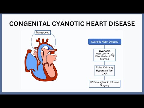 Congenital Cyanotic Heart Disease