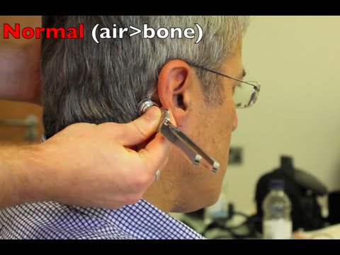 Rinnes and Webers test