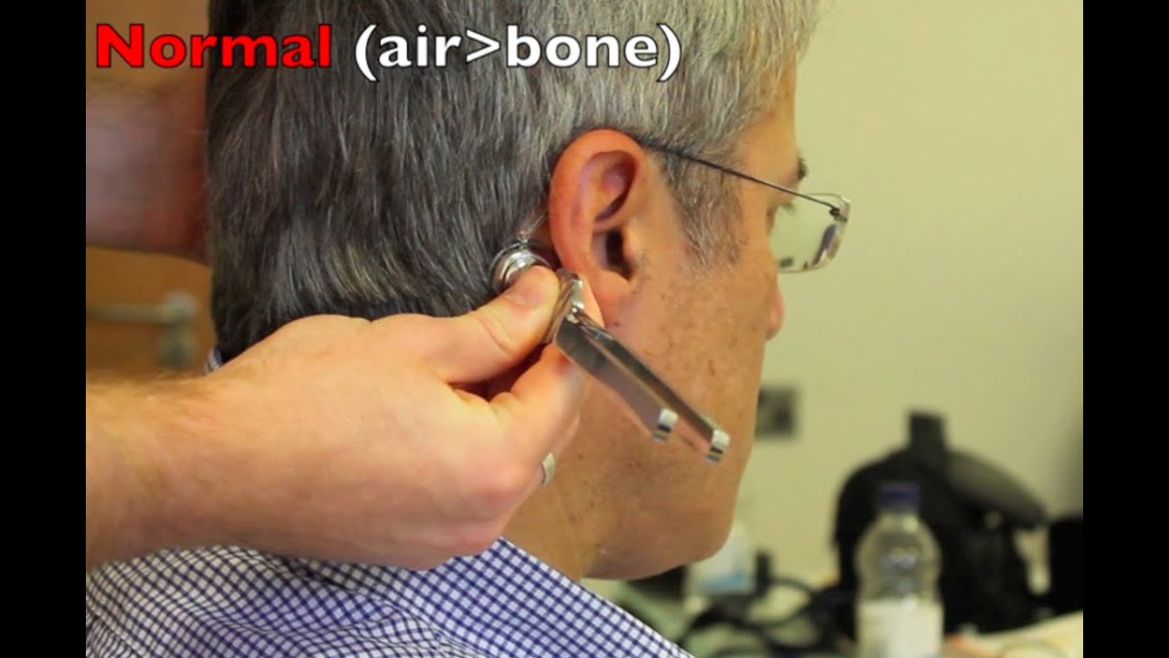 Rinnes and Webers test