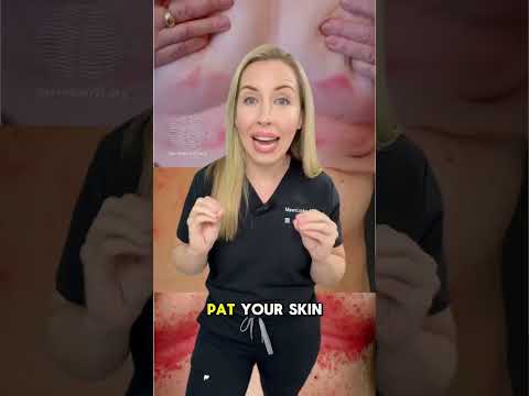 How to fix this red, itchy rash in skin folds called….INTERTRIGO!  #dermatologist #skincare