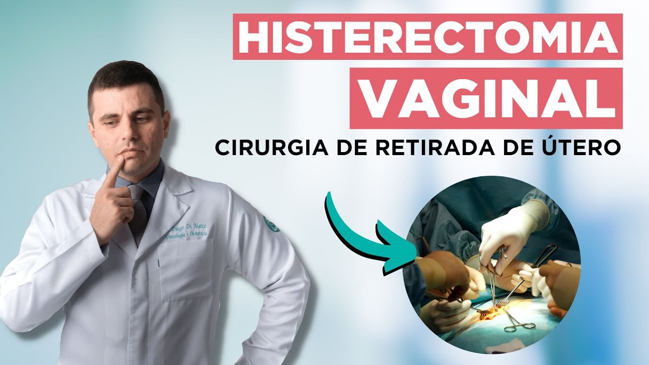 HISTERECTOMIA Vaginal: Procedimento, Recuperação e Benefícios