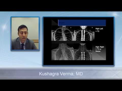 Adolescent Scoliosis and Adult Spinal Deformity- Discussion on Care & Treatment