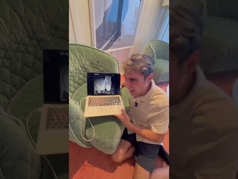 Shine - James